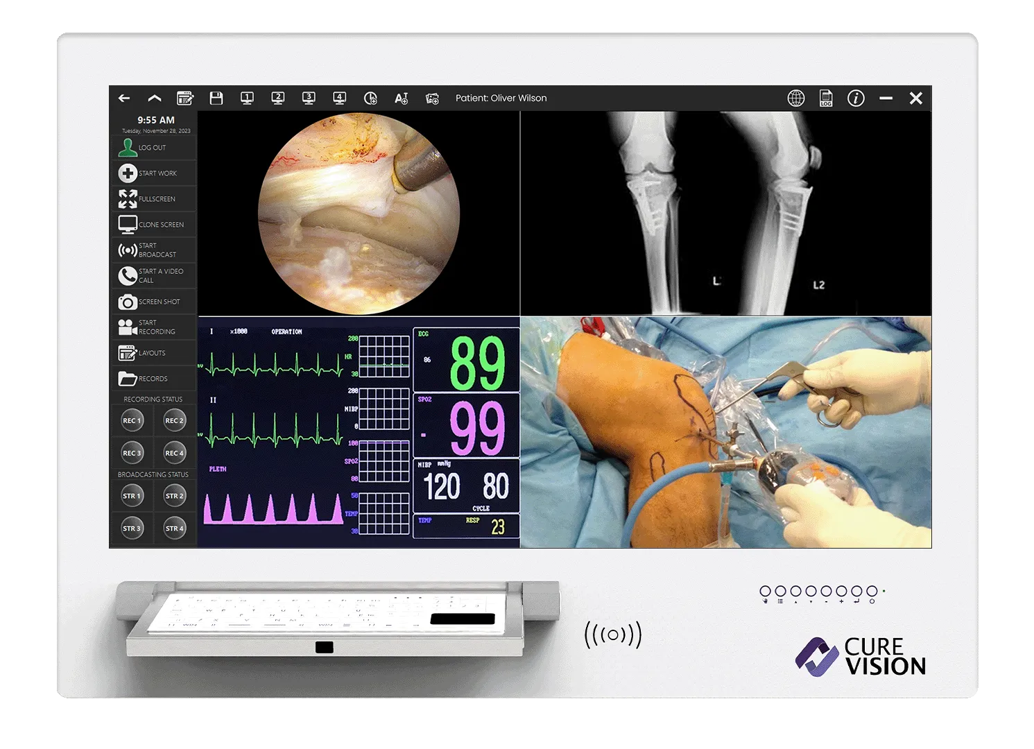 CURELINK | Surgical Recording, Digital Negatoscope & OR Telemedicine