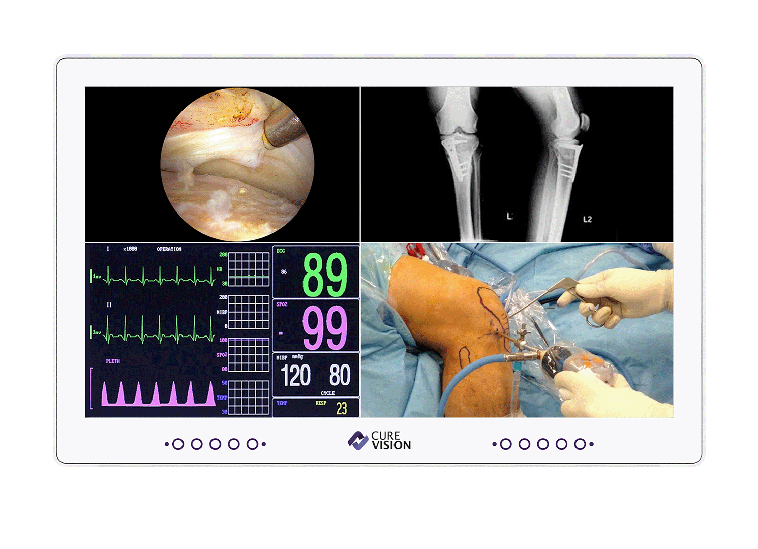 Surgical Monitor
